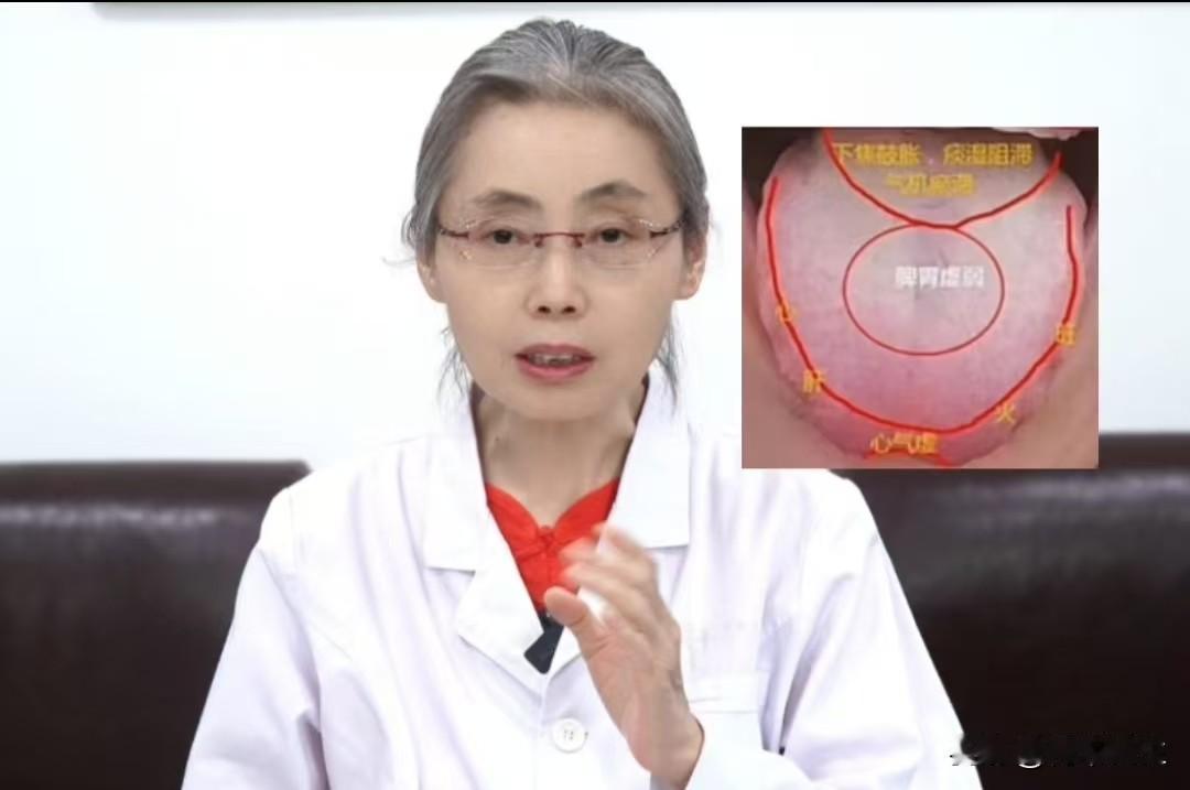 这种舌象很是难调，上焦有火，中焦有湿，下焦有瘀！

这位患者目前最主要的问题，就
