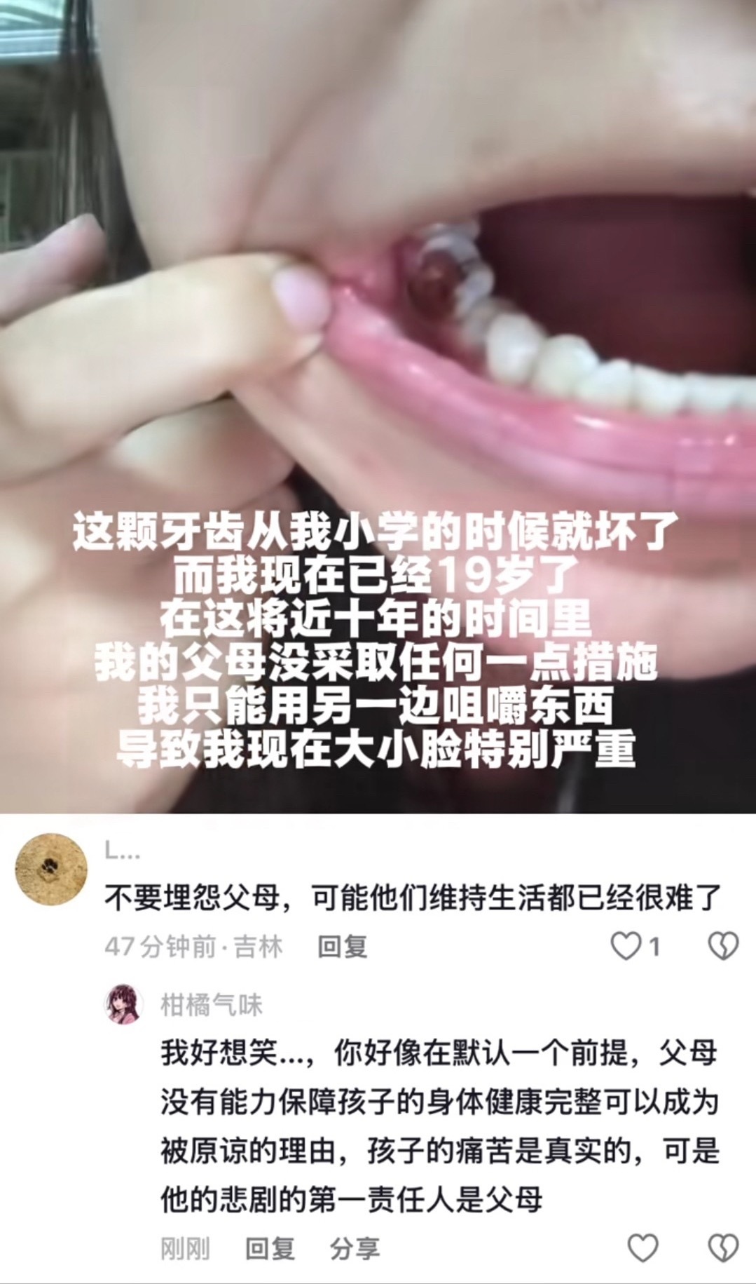 反矫 