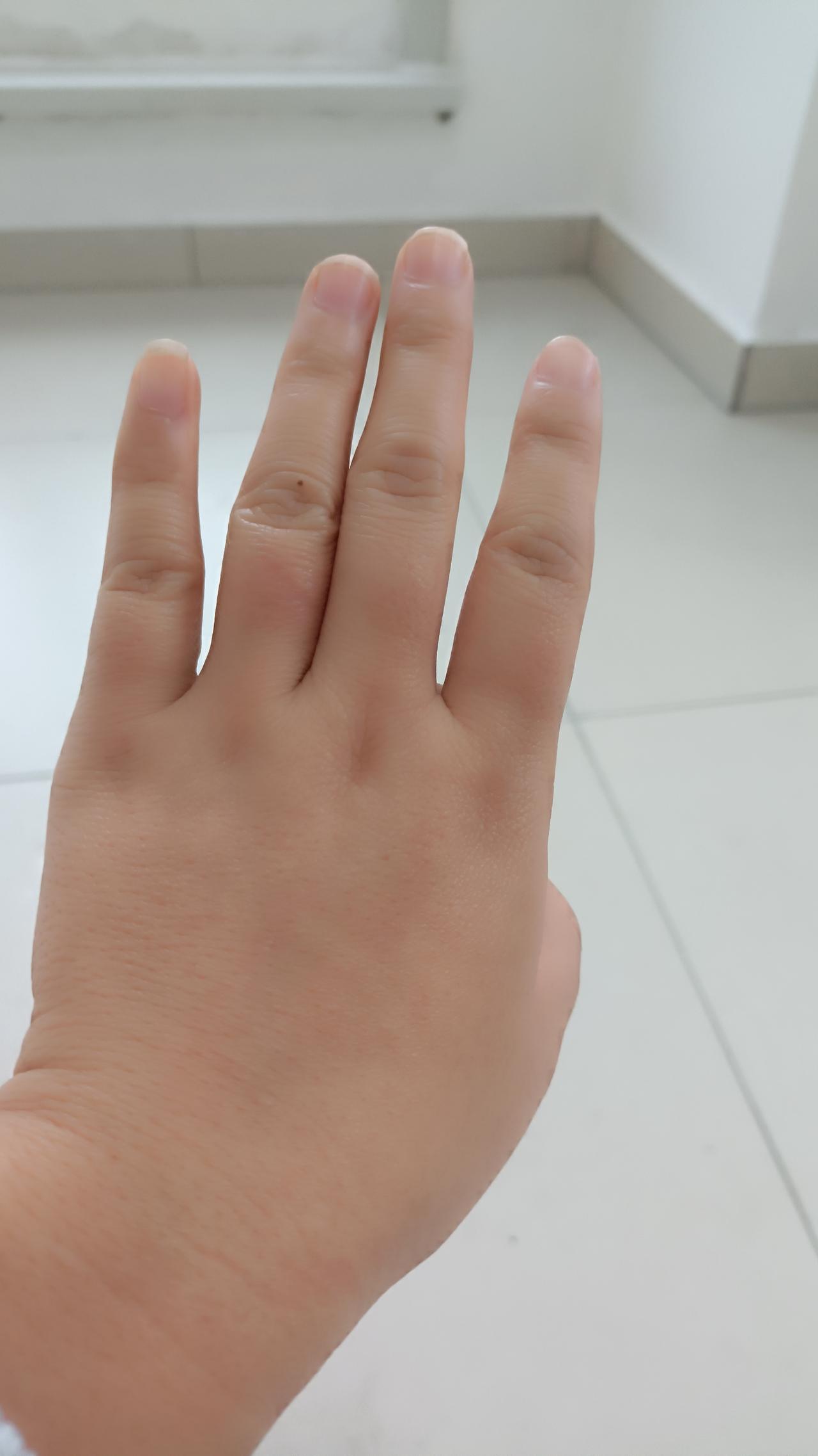 这两天在医院接触了很多护士和医生，都是女人，但是她们的手部状态有明显区别。
医生