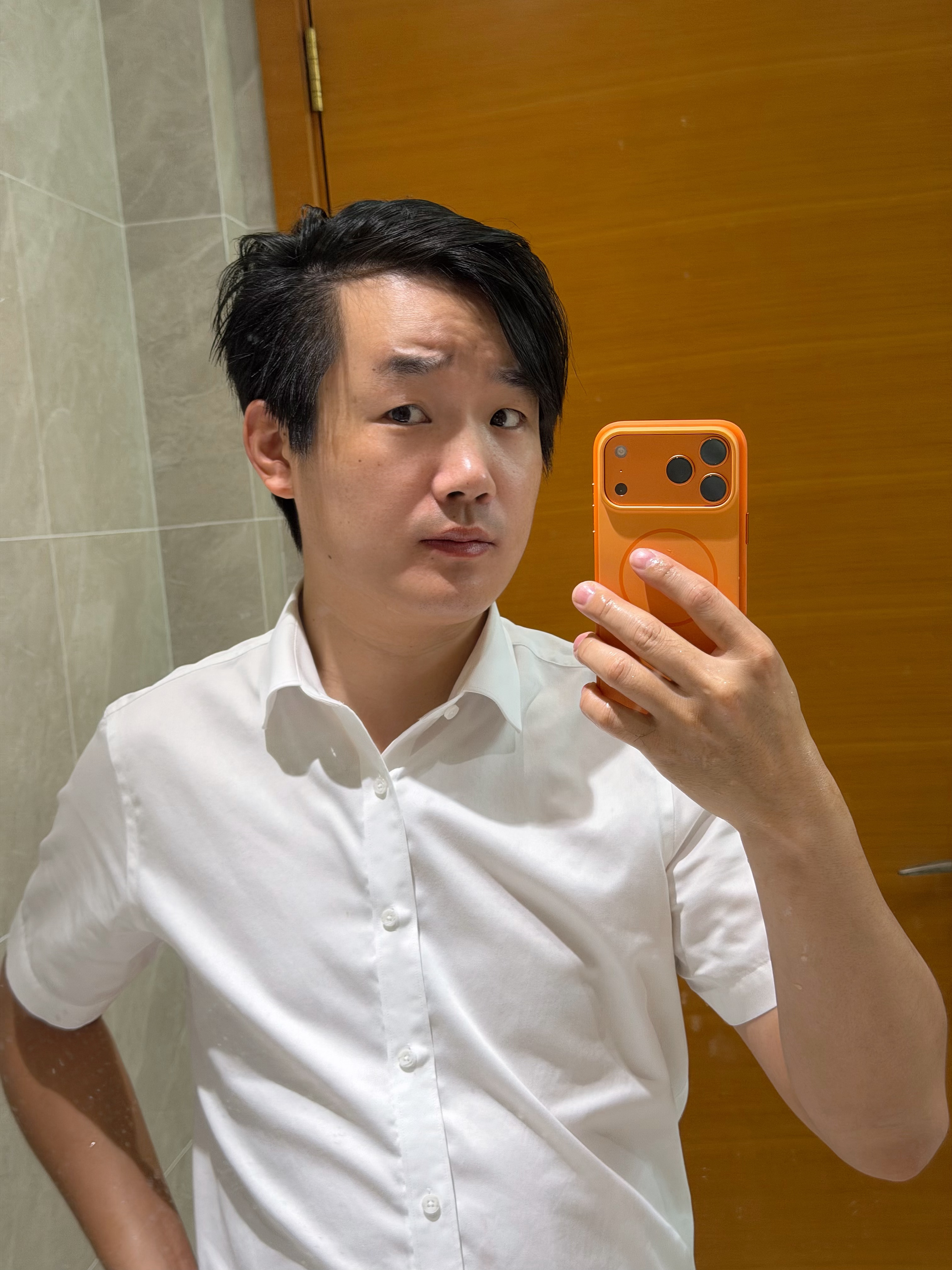 准备下个月植发，头发虽然多，但属于M形脱发 