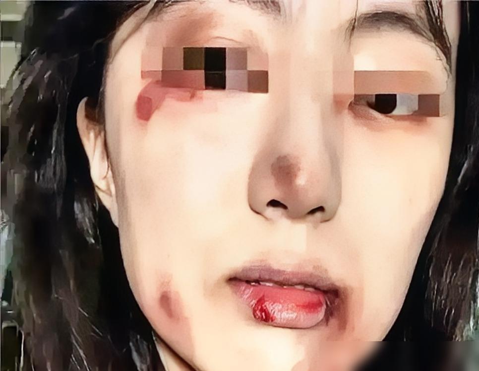 产后第12天，儿媳从厕所出来腿还在打颤，丈夫劈头盖脸就骂：“上个厕所用二十分钟，