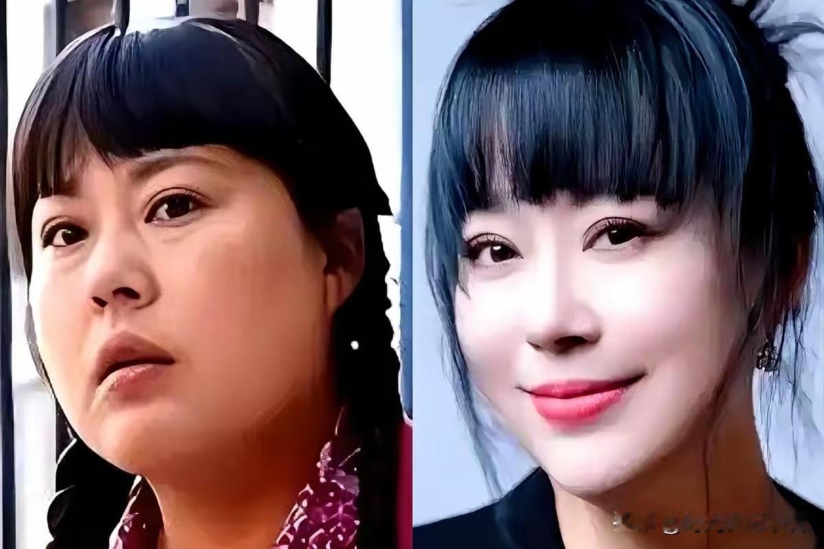 太瘦了吧，李菁菁这突然暴瘦，虽然说是身体出问题了，其实还是可以减肥了，因为如今娱
