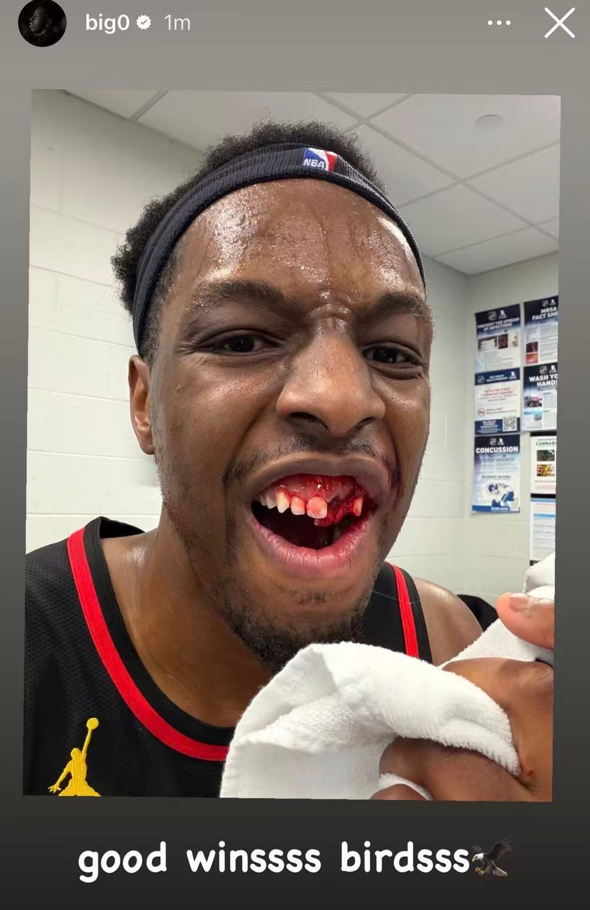 可以接口腔广告了chinahawks // 亚特兰大老鹰