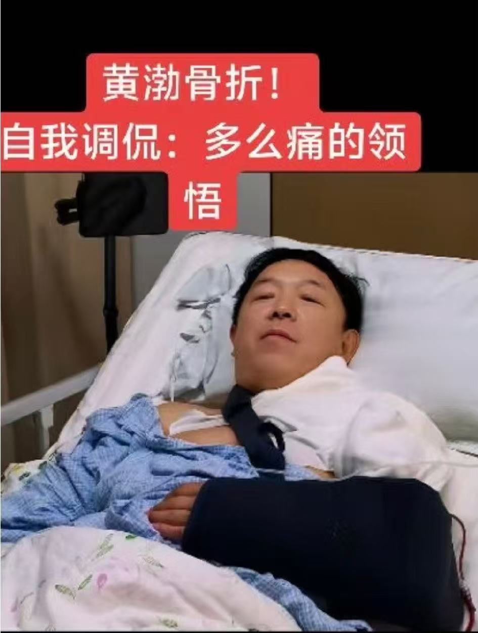 黄渤骨折还在录喜单总决赛骨头断了段子不能断，黄渤老师这敬业程度我给跪了。打着石膏