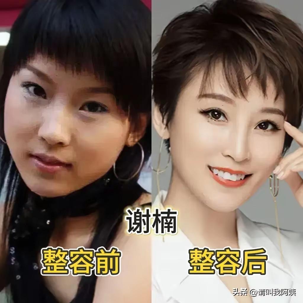 都说这些女明星整过容，我是不相信的，只不过是化妆技术不一样了而已
谢楠，这明显都