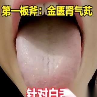 有些事儿算是捅破了窗户纸。
就说身边总有这么一种人，碰一下凉的，肚子就咕噜咕噜响