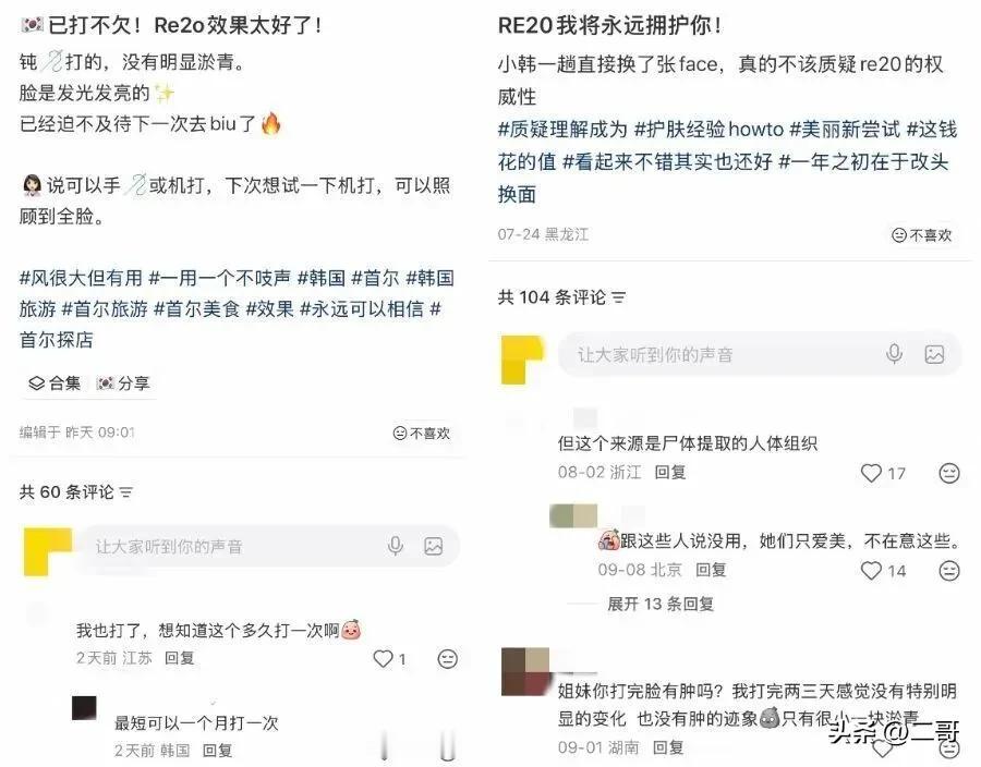 花3000块钱，把死人的皮肤打进自己脸里。
 
这不是恐怖片，是韩国医美圈最近最