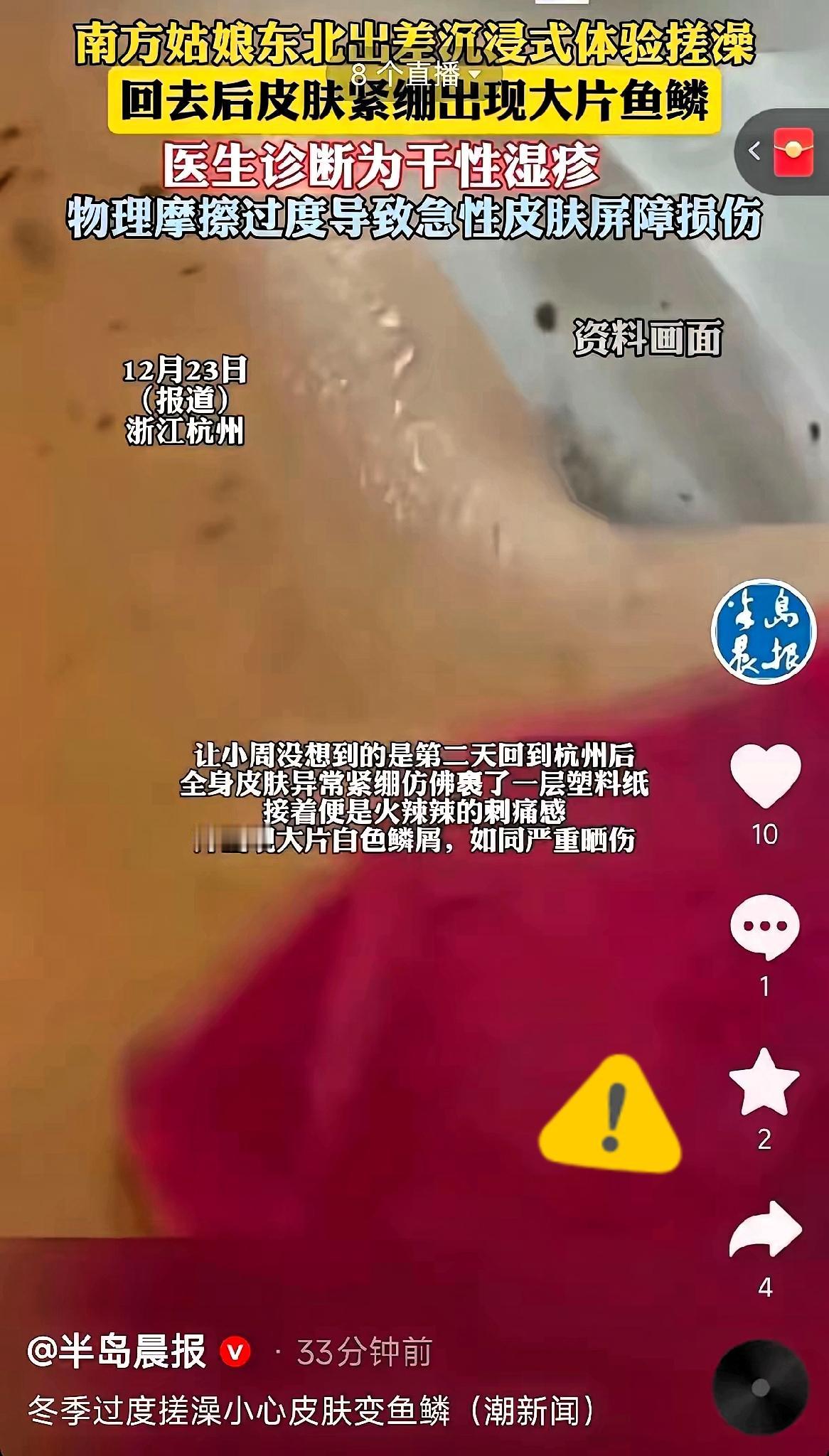 谁能想到！杭州姑娘东北搓澡搓出“鱼鳞皮”，这事儿真给所有爱干净的人提了个醒！
 
