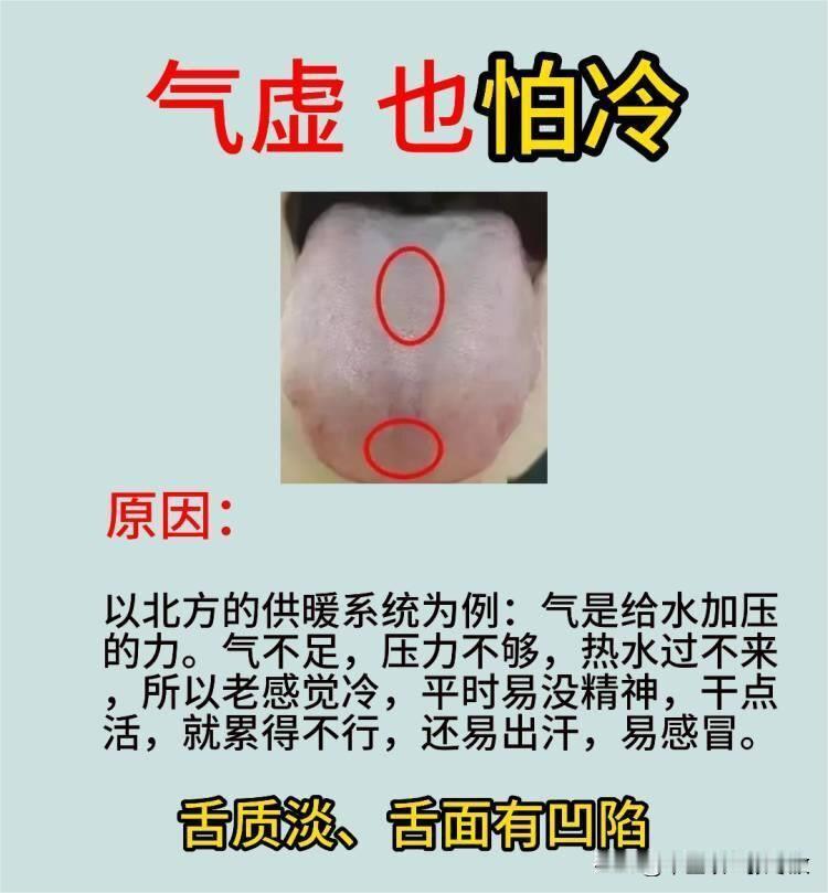 血虚怕冷，阳虚怕冷，气虚也怕冷！[奋斗][奋斗]
三种舌象带你分析

图1：气虚