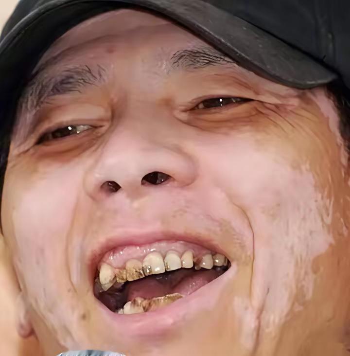冯小刚这么有钱，难道还差个洗牙钱补牙钱吗？其实这才是人家冯小刚的高明之处，这样原