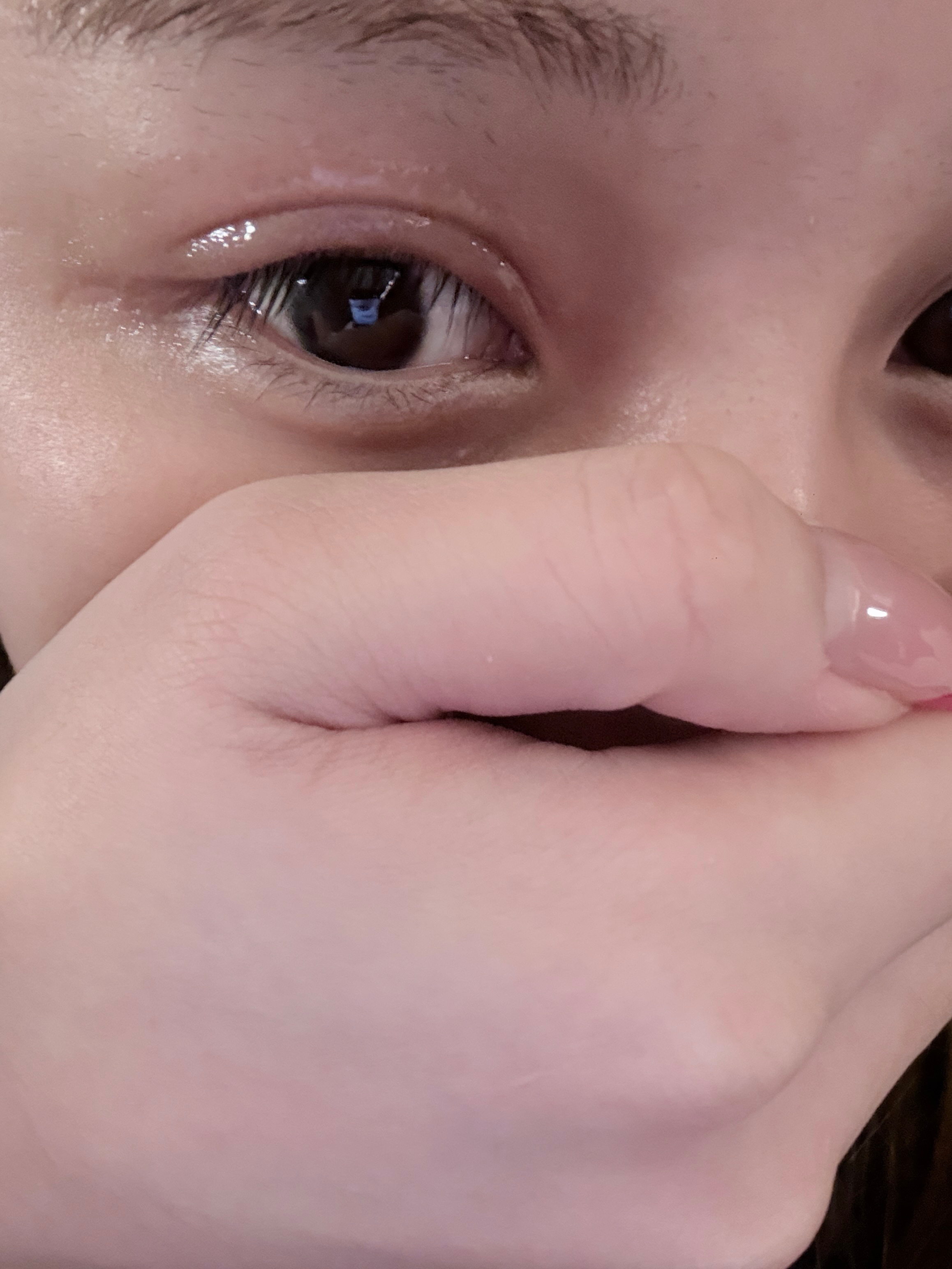 第一次麦粒肿到眼皮上 肿的像被人揍了[泪奔][泪奔] ​​​