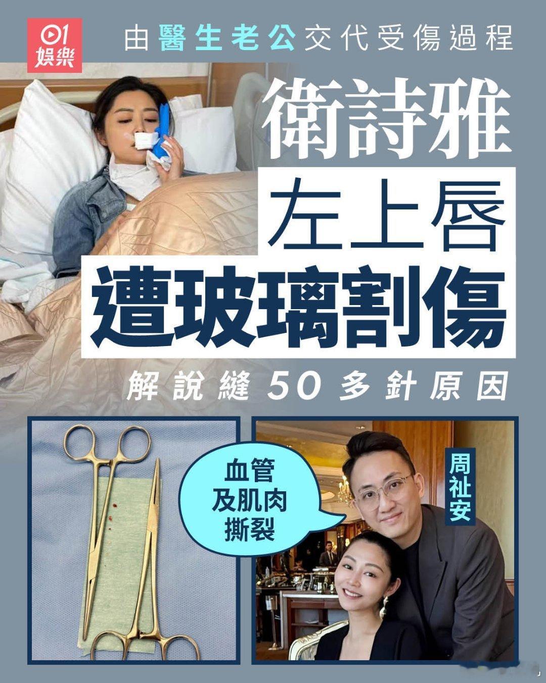 卫诗雅全面停工卫诗雅是拍摄《一九七一》受伤的，不是拍摄《狩谎》受伤的呀，怎么那么