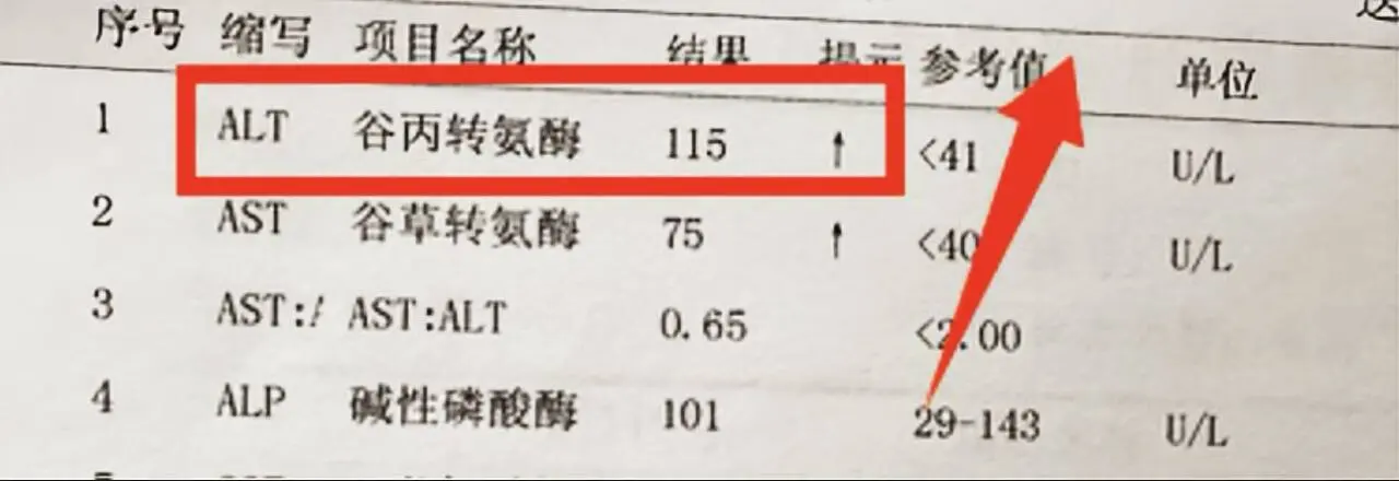 转氨酶升高到80以上，这几项检查抓紧做。1、病毒学检查：转氨酶上升时...