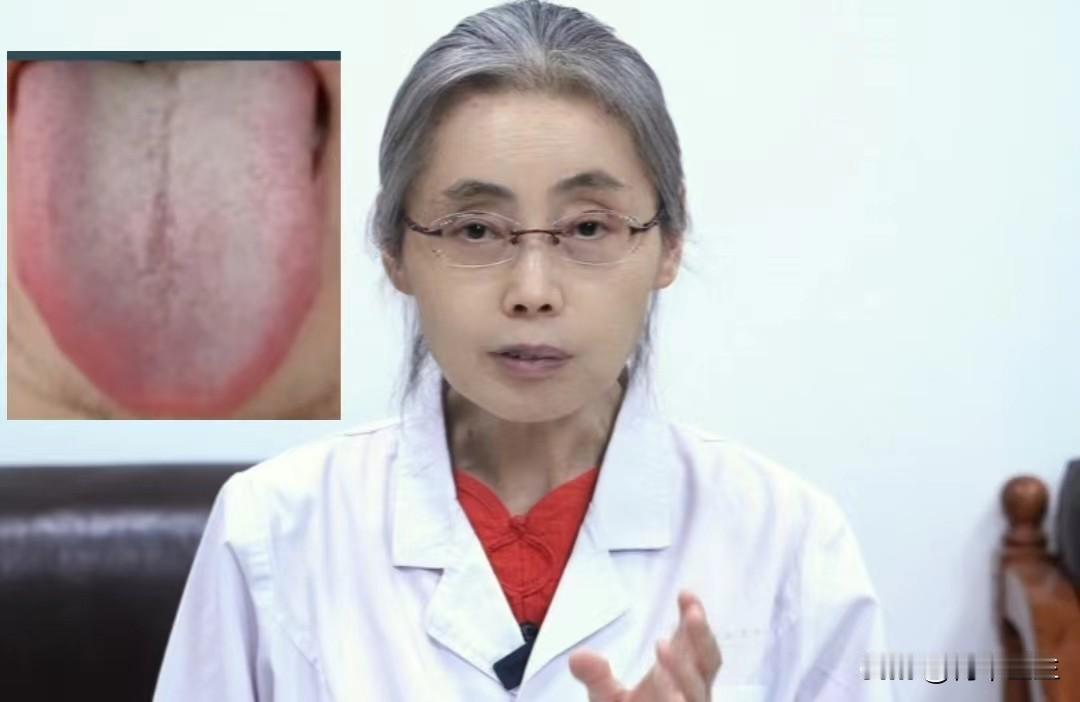 舌红苔白，寒热交互，想调理就要从肝入手

王先生，36岁，主诉：爱上火，心烦气燥
