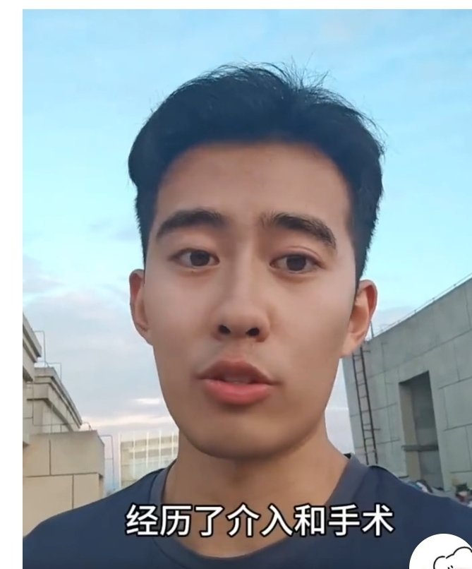 25岁确诊癌症晚期后的忠告他已经抗癌很多年了，怎么突然上热搜了！ ​​​