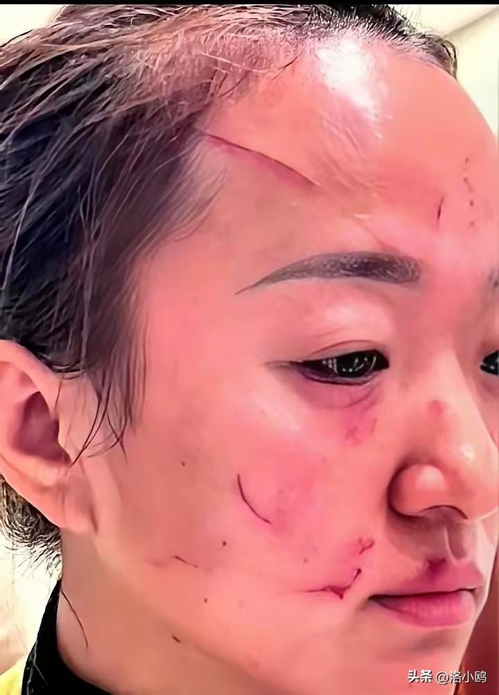 这就是打脸吗？挺可悲的，这是一跟勺子的事吗，这明明是日积月累的婆媳矛盾！

洛阳