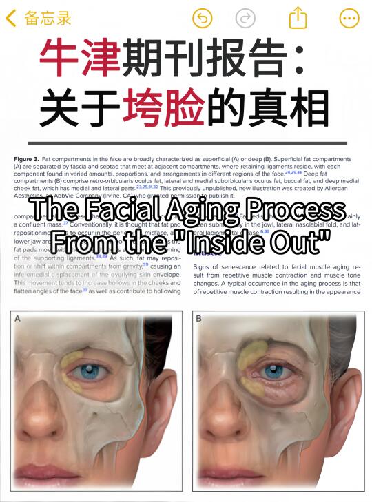 牛津大学期刊：揭示脸垮的真相🔥