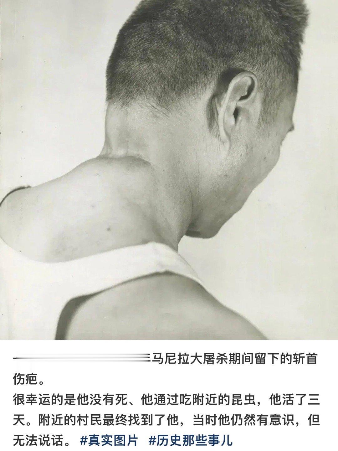 天啊 忍不住感慨人类的生命力 ​​​