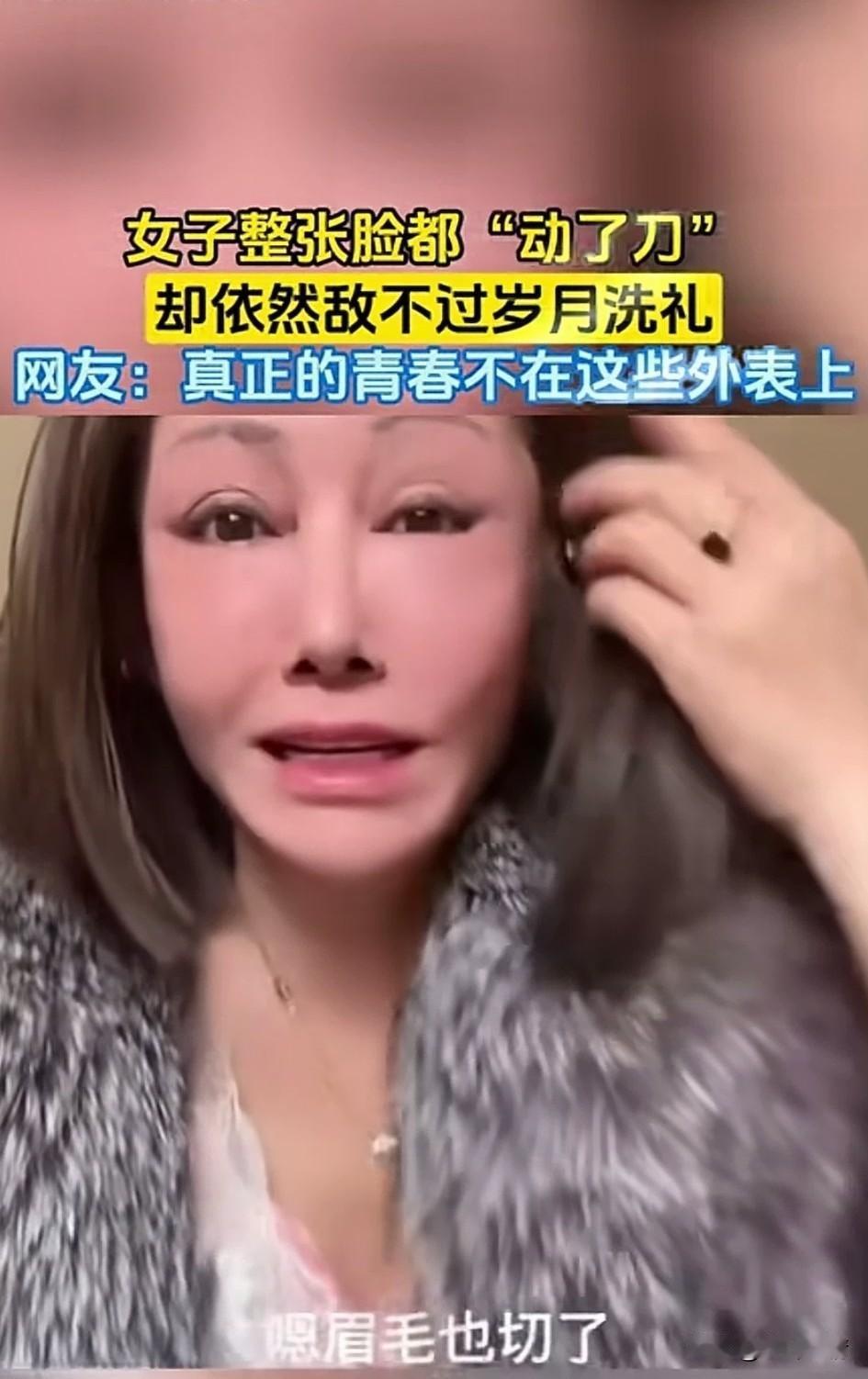 女子年龄大了，但是为了美，
她的整张脸都动了刀，
但看着自己的面容还是觉得丑，