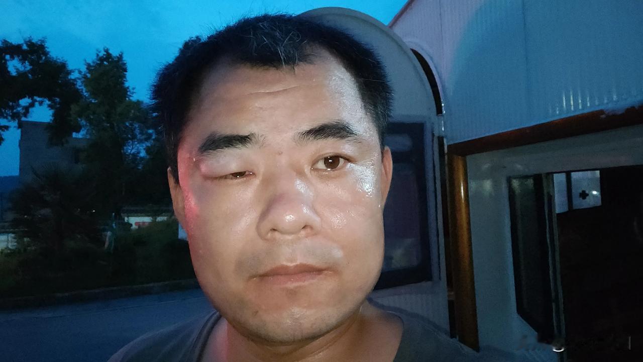 本来就丑，这下更丑了吧！😄😁
