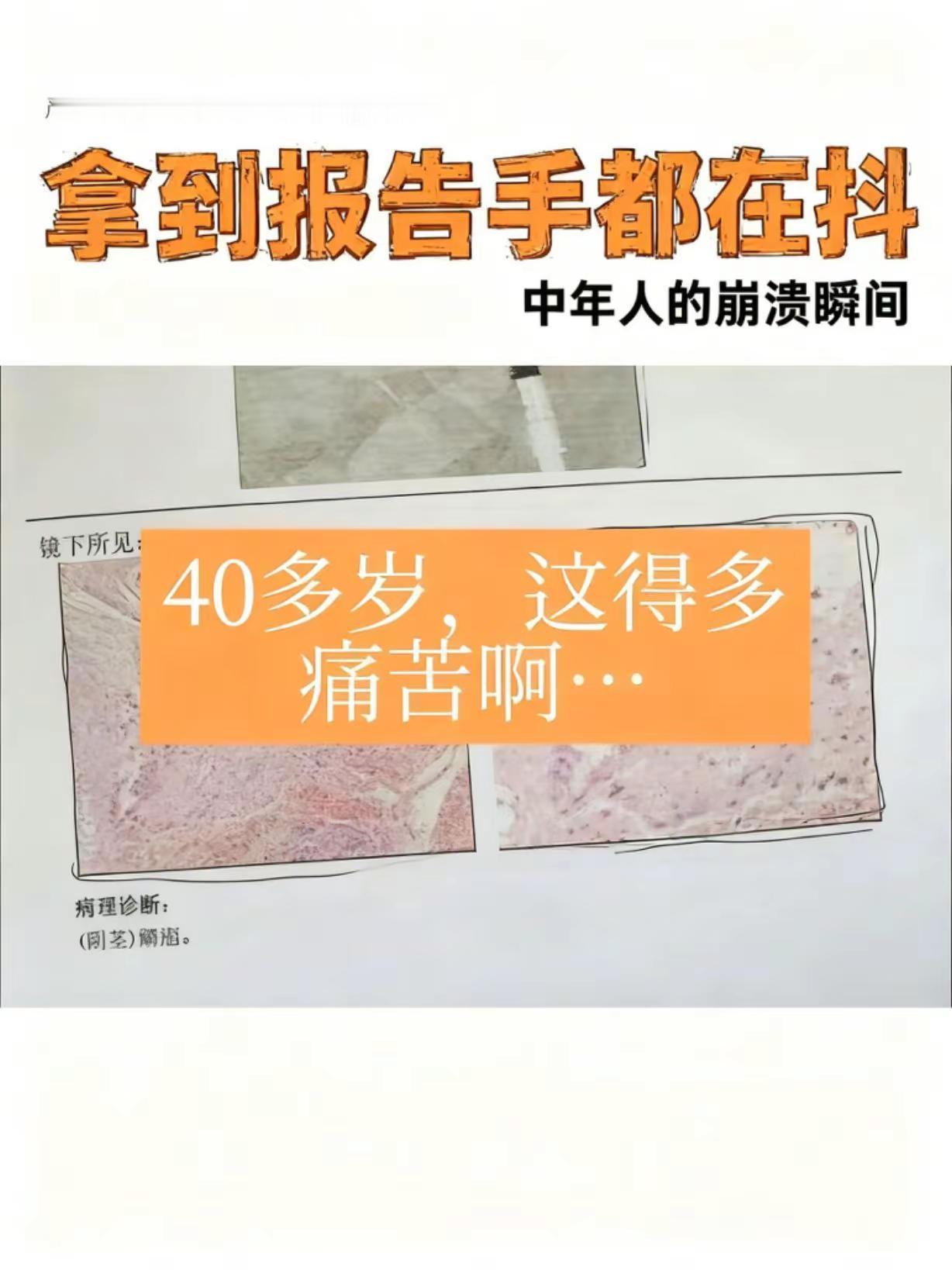 这得多痛苦啊，年纪才40多 …我觉得这种痛苦只有男生能感觉到到男人懂男人蛋仔派对