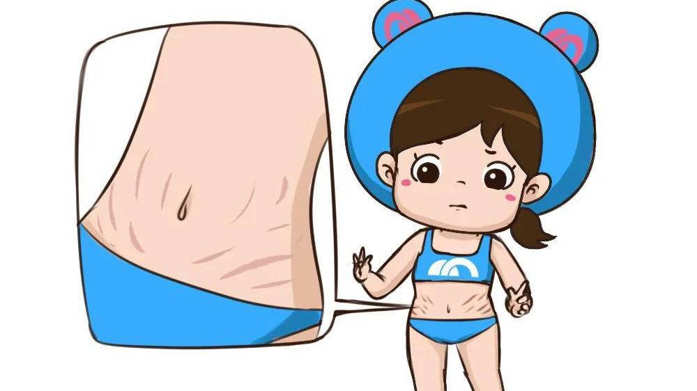 #健康真探社#【为什么身上会出现肥胖纹？】玩过气球的人可能会注意到这样一个现象：