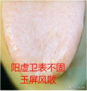 吃个饭一头汗，别只会用玉屏风了，分享3个更全面的，快速止汗！
玉屏风散
功效：益