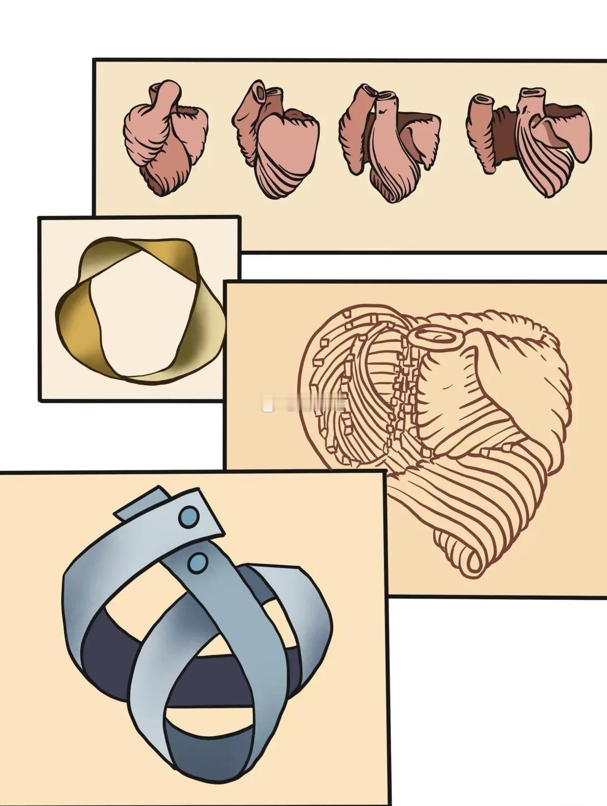 【心脏是一个“莫比乌斯环”】西班牙医生 Francisco Torrent-Gu