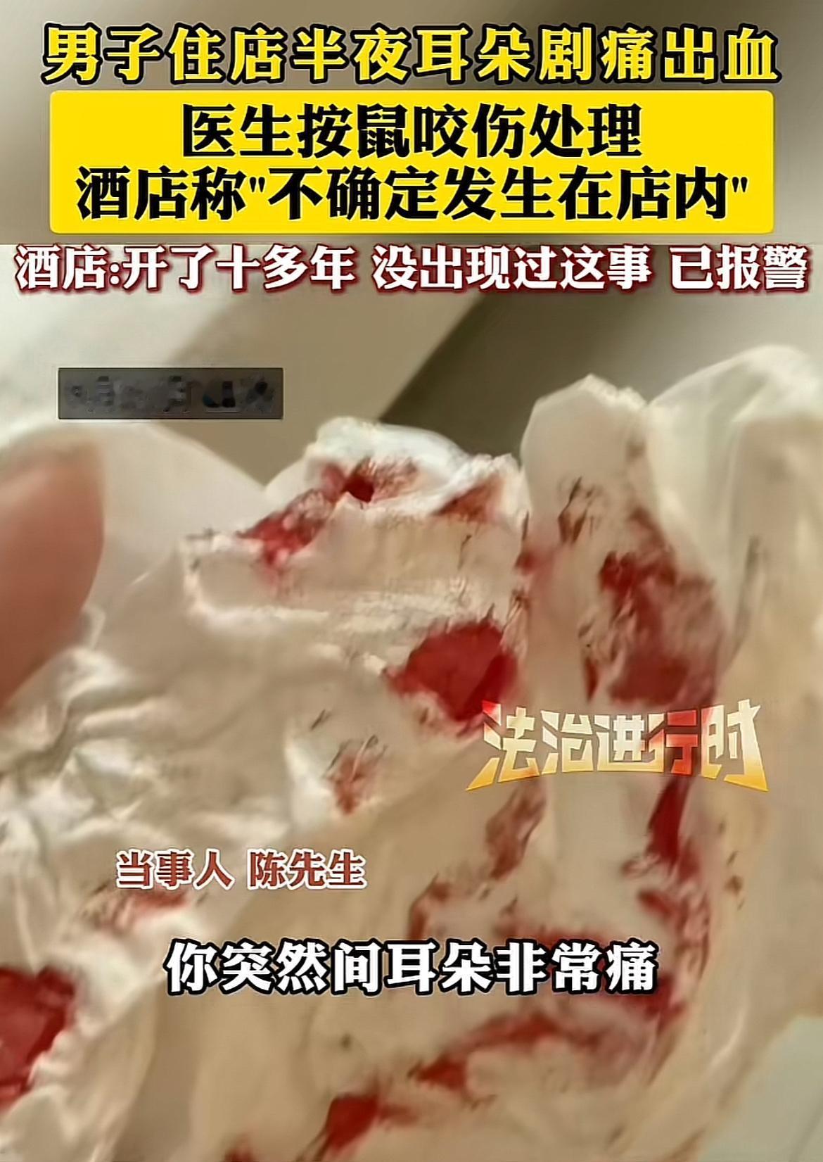 “倒大霉了！”

上海一男子半夜在酒店睡觉，

耳朵突然被东西咬得生疼，

开灯