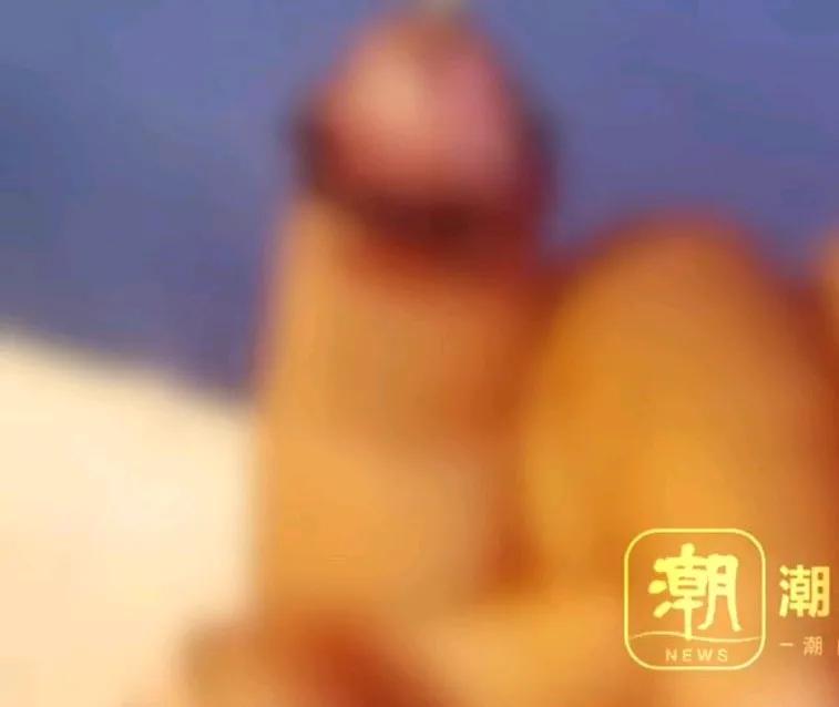 一岁男童喂兔子时，手指被咬断，家长为找断指将兔子开膛破肚，妈妈说误以为被兔子吞进