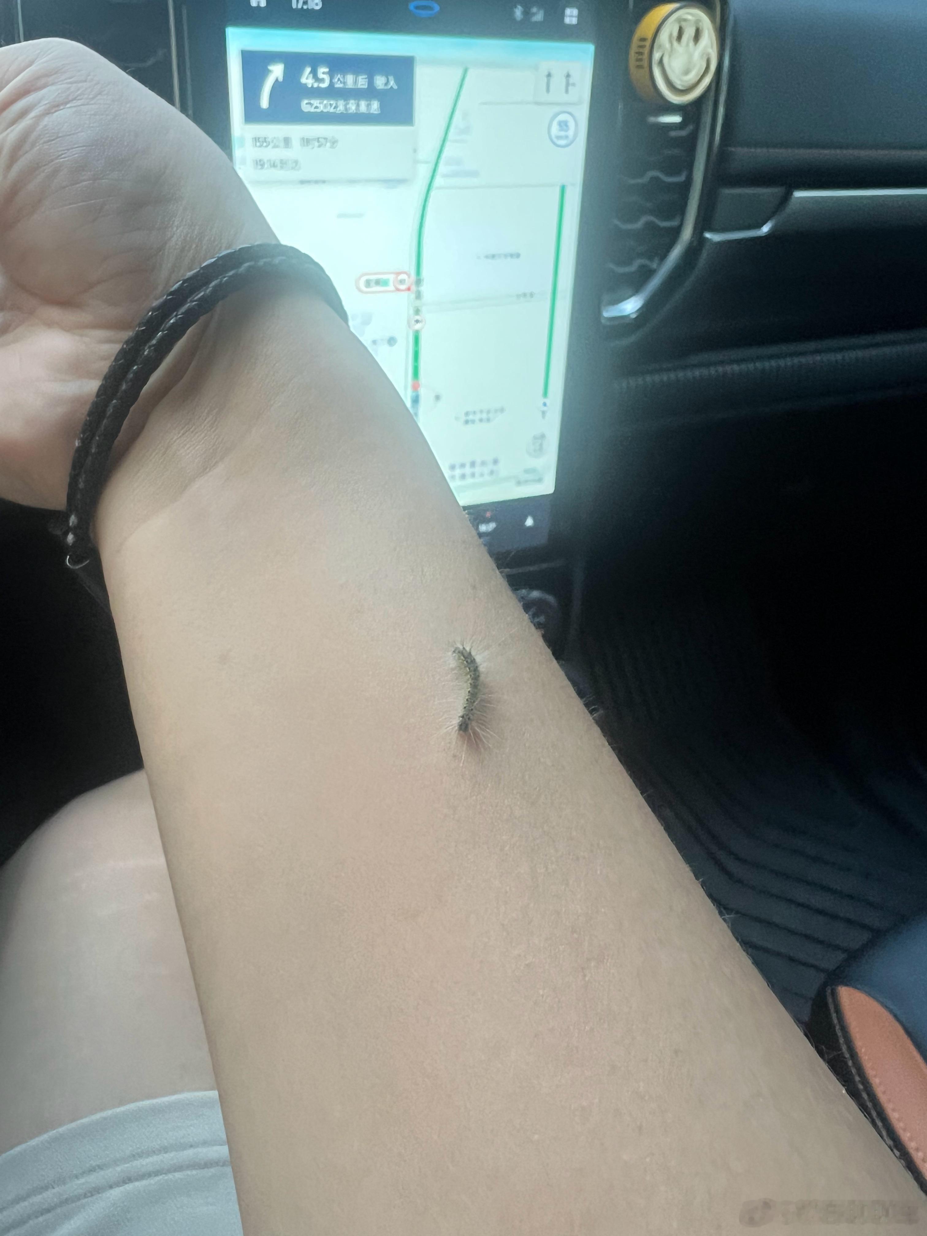 开着车，忽然感觉手臂一点点痒～ ​​​
