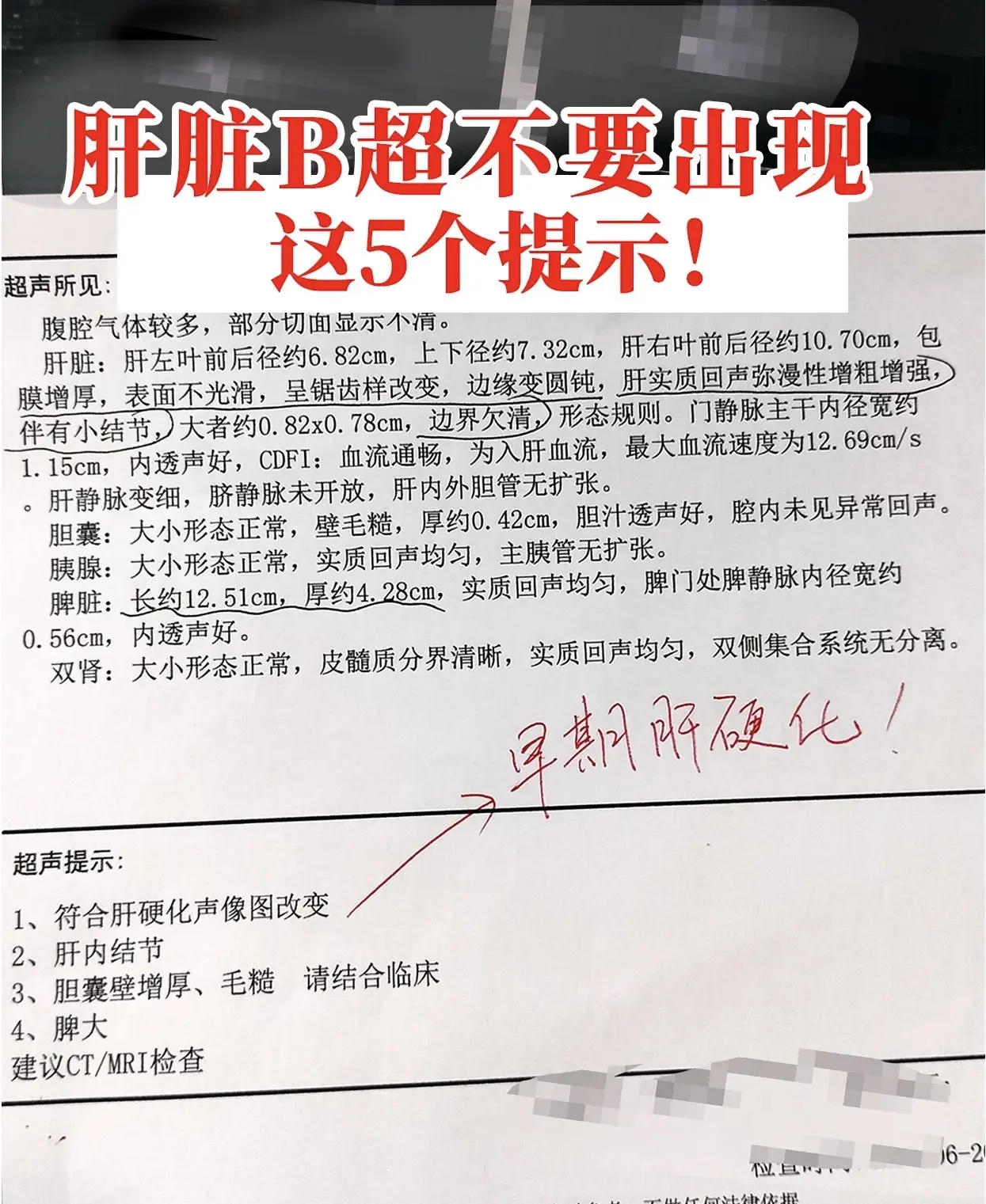 肝脏彩超没有这5个提示，说明病情还算稳定 这是一位山东患者的肝脏彩超...