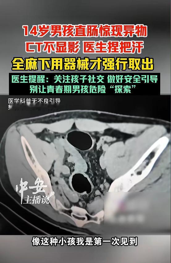 “悲剧还是发生了！”近日，广东深圳，一14岁男孩因一时好奇，将一根异物塞进了自己