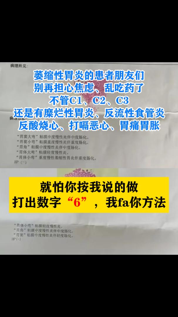 大家好，我是中医彭家胜，从事胃病临床工作已经五十多年了，对萎缩性胃炎...