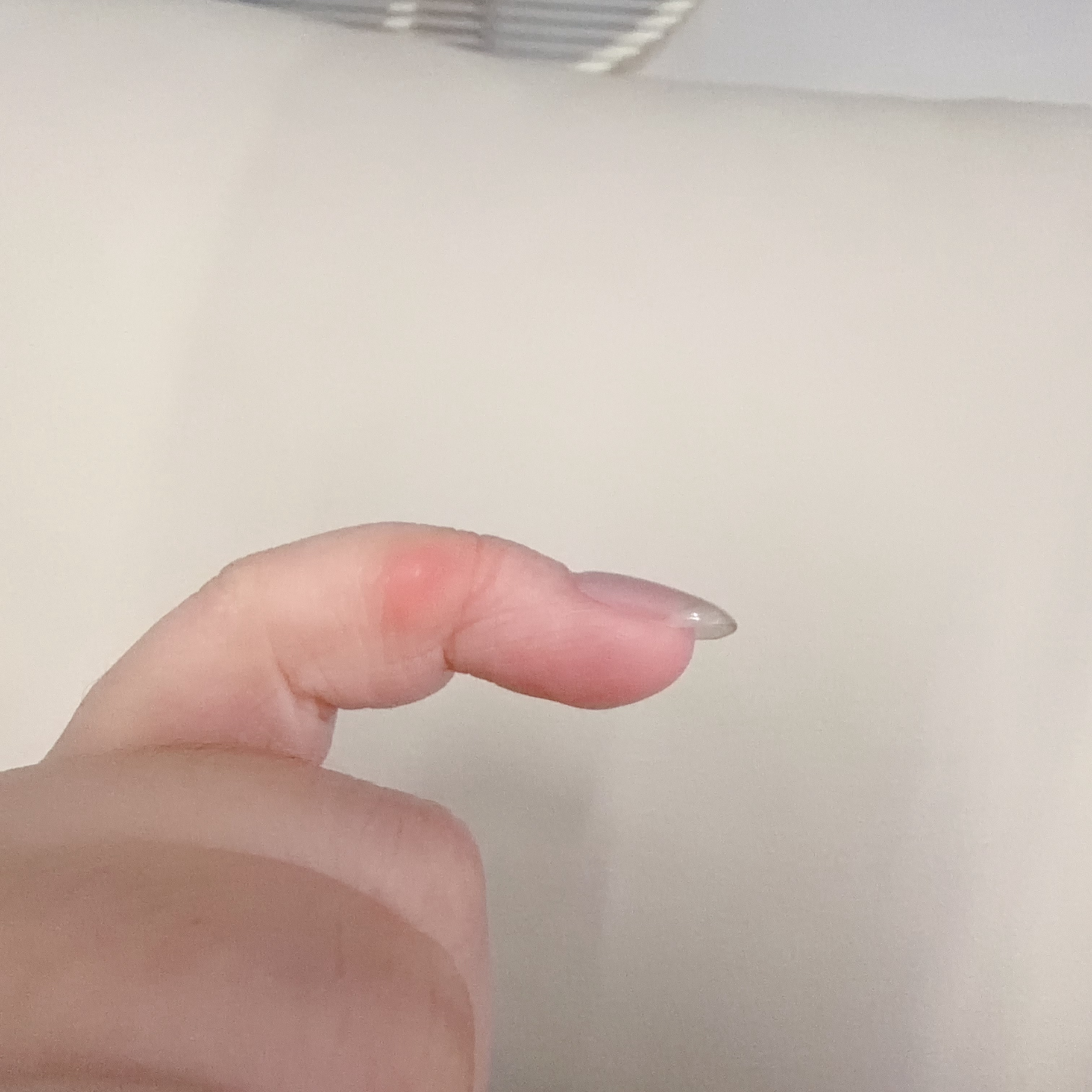 发现中指的握笔茧消失了是真的握笔茧小了很多手机茧越来越大