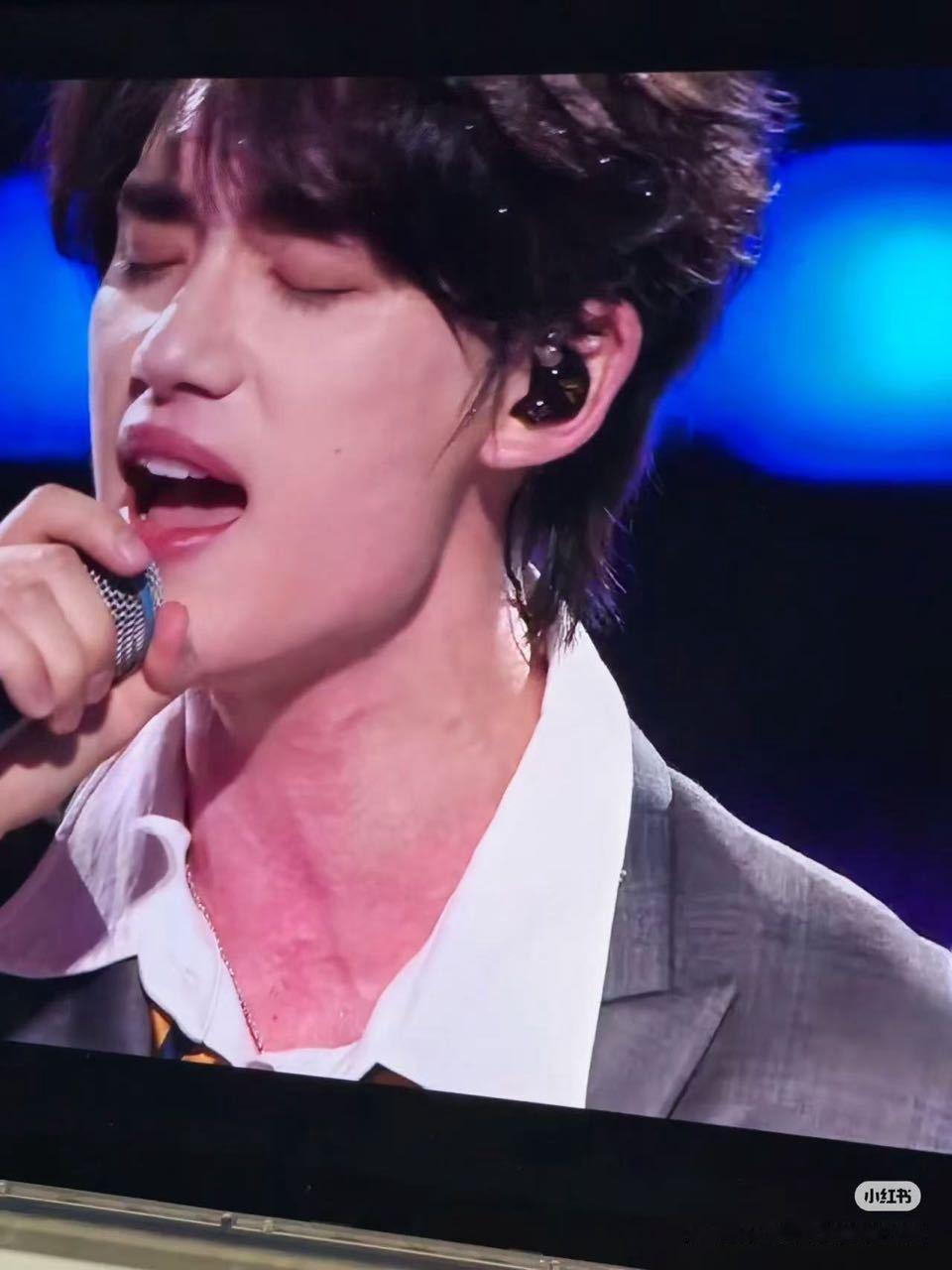 tg：昨天丁程鑫这个脖子是怎么了？怎么这么红啊？？时代少年团海口演唱会 ​​​