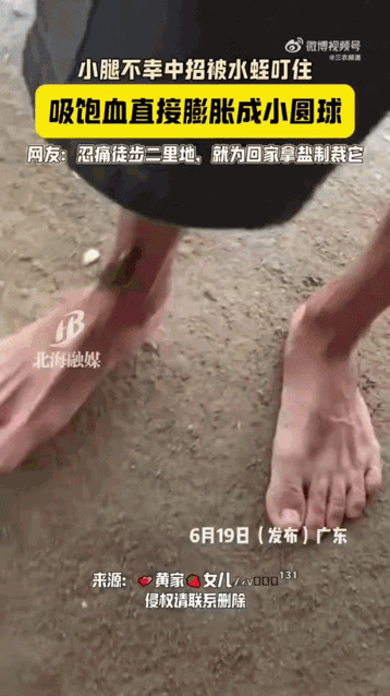 它吸饱了。

这是它这辈子最后一顿饱饭。

水蛭这玩意儿，几万年来就靠一招活着。