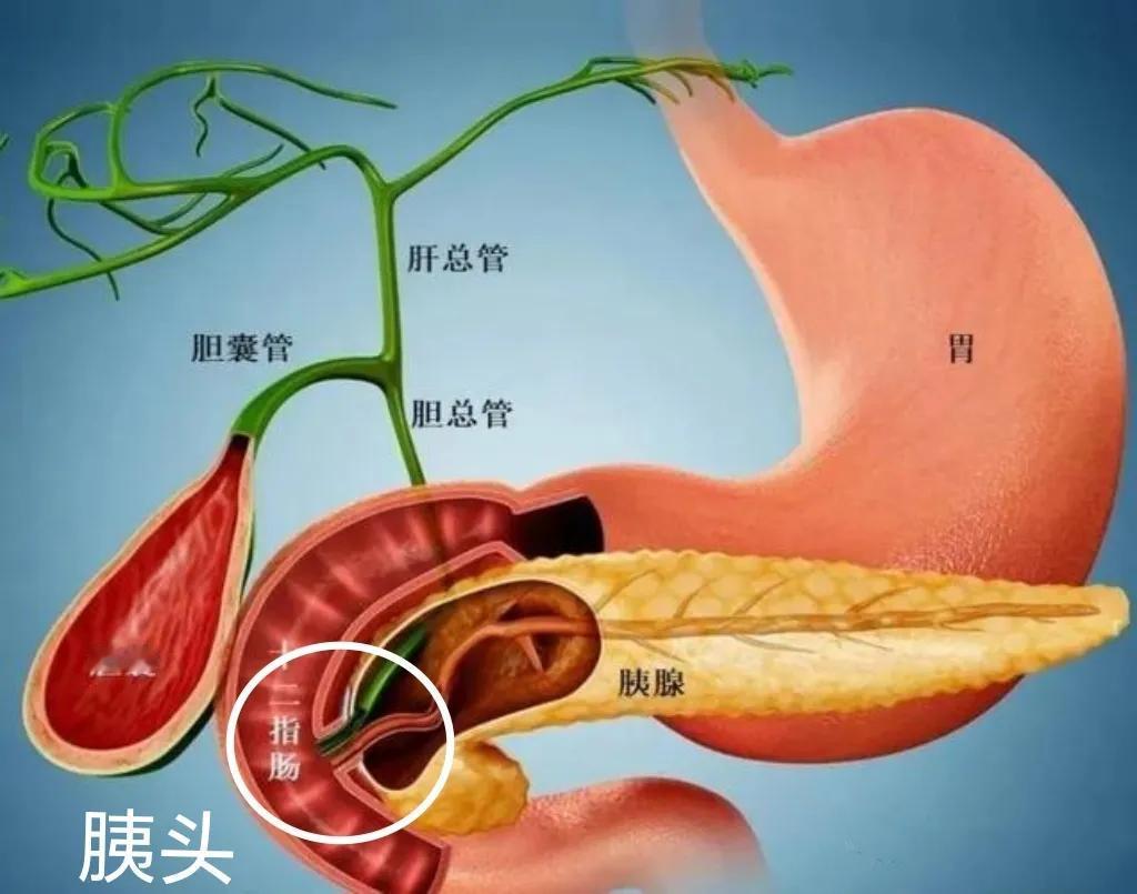 大手术！[发怒]
该位置，切除治疗难度很大！

这是人体消化系统示意图，展示了胃