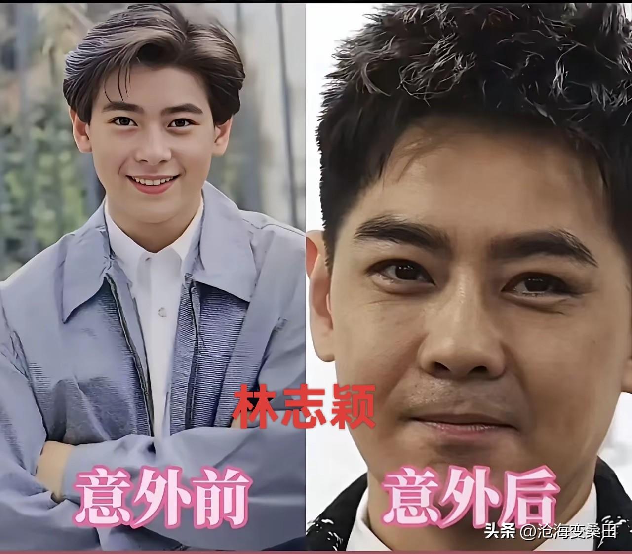 因意外毁容了的9位明星，星途各有不同