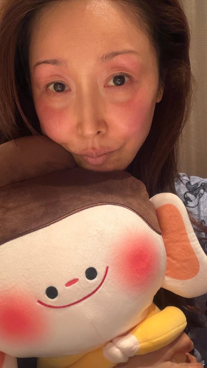 孙悦录春晚脸被冻伤 孙悦姐姐真的太敬业了，脸被冻伤还坚持工作。希望她能好好休息，