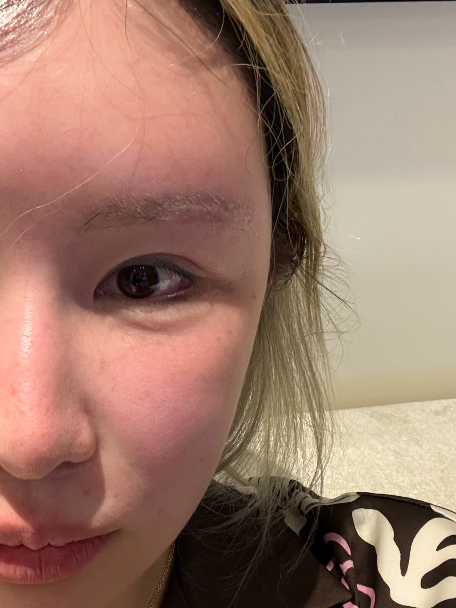 我是真的服普丽兰的褪红功效的！大概敷了20min出头，面部潮红就褪下去了。有轻微