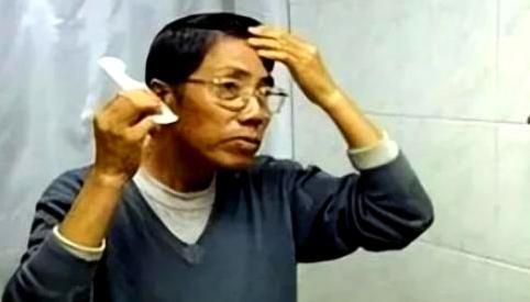 2000年，在黑龙江，一位年近五旬的大叔接受了心脏移植手术，供体来自一位26岁的