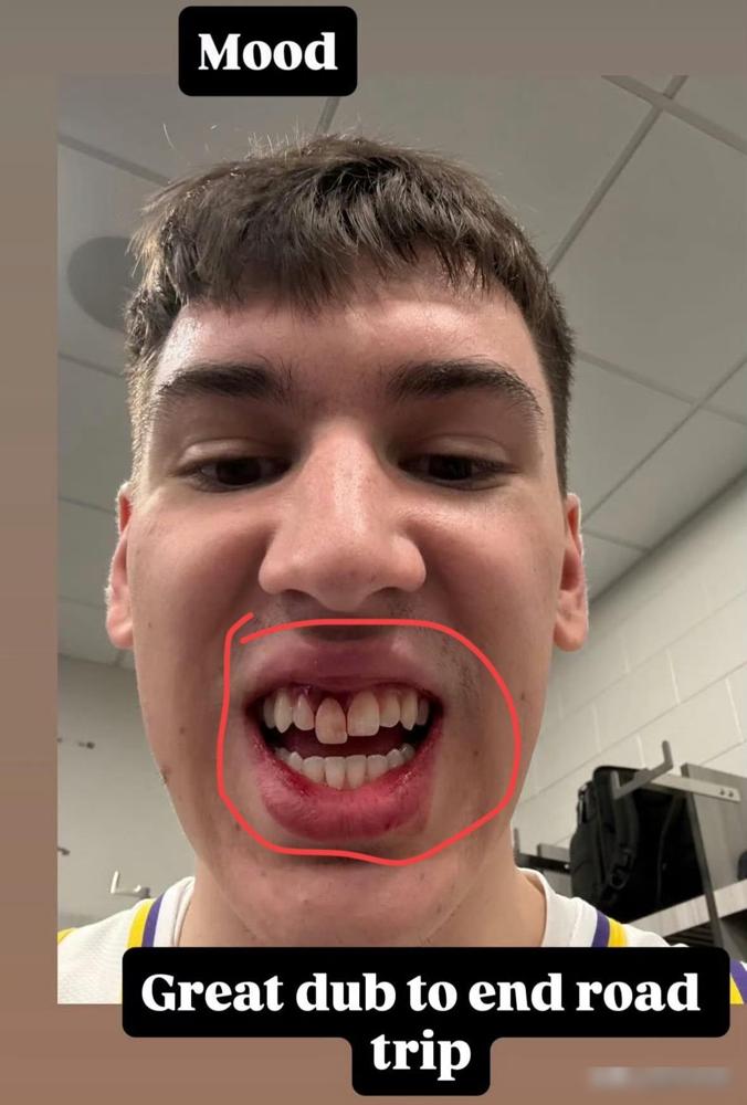 拉拉维亚说话要漏风了！赛后，湖人队球员拉拉维亚在社交媒体上晒出照片，照片中这位帅