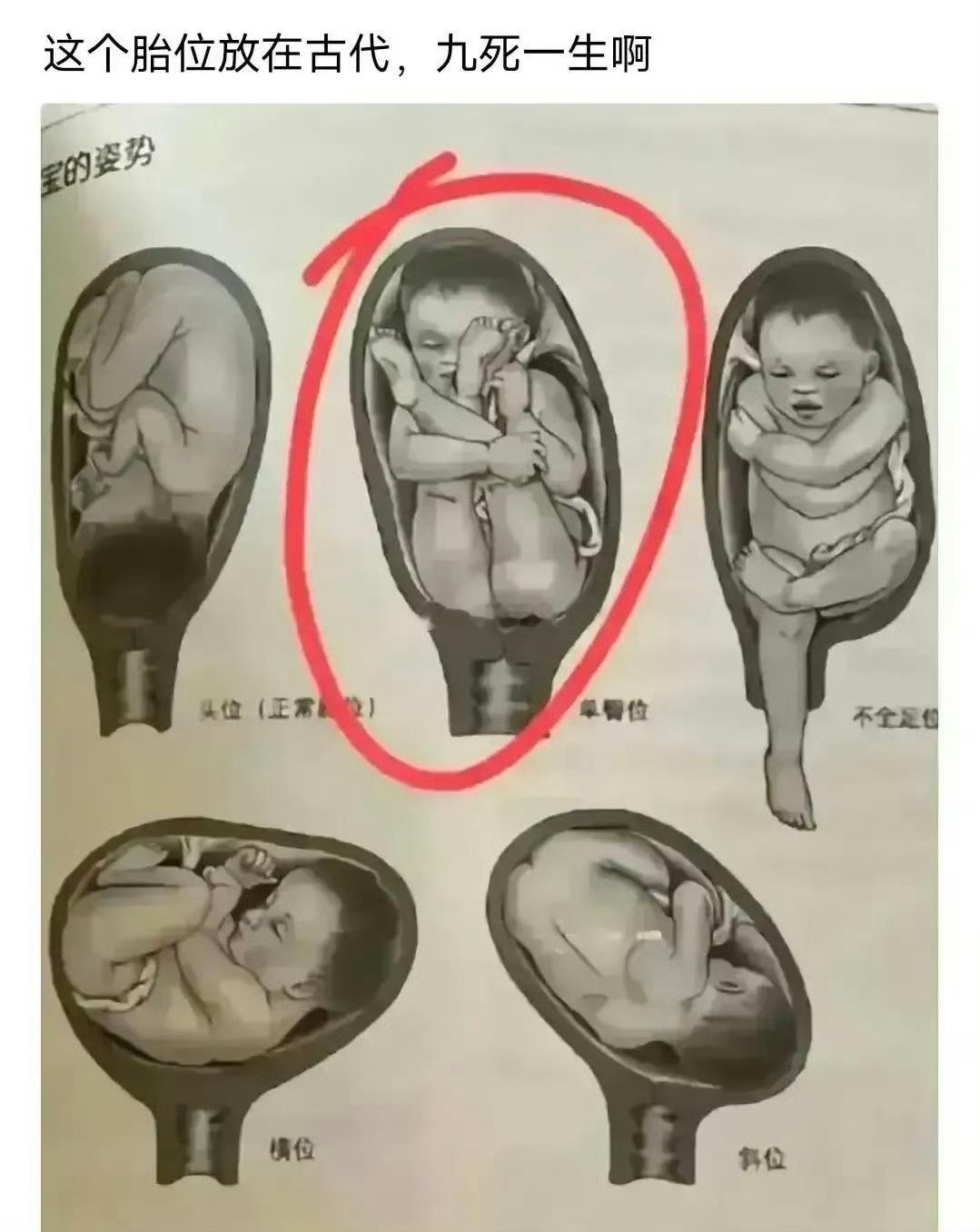 这要是放古代100%难产 ​​​