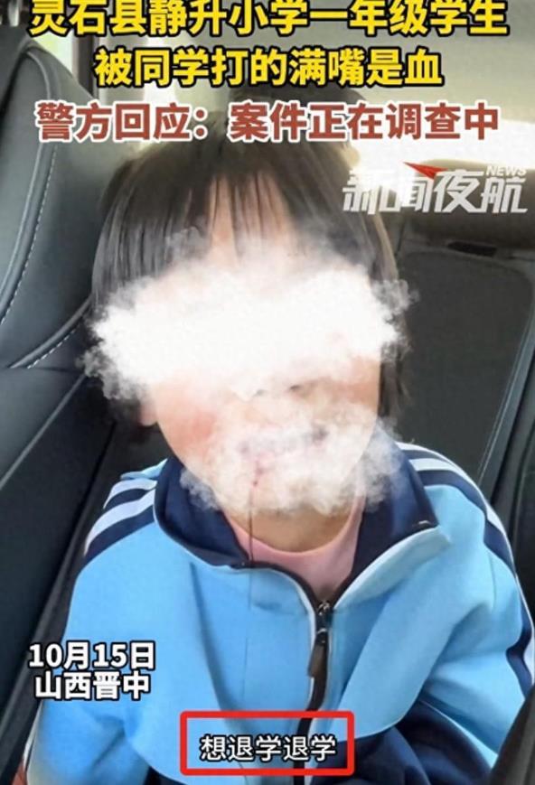 一年级女生被同学霸凌，满嘴是血，且不让找老师。学好《未法》，认其人之道还治其人之