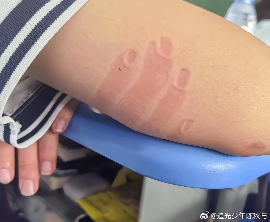 这才是真正的人体皮肤拓印第一次见这么骨节分明的手人怎么能睡成这样[哈哈]校园热梗