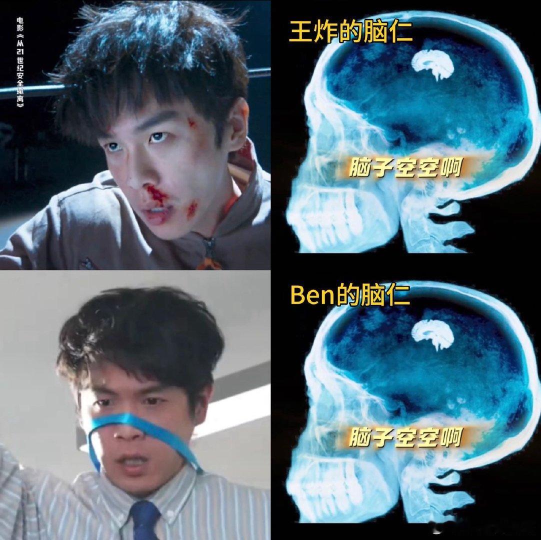 张若昀benben的就会顺顺的张若昀的脑仁还没长出来 魏晨说张若昀“脑仁小”原来