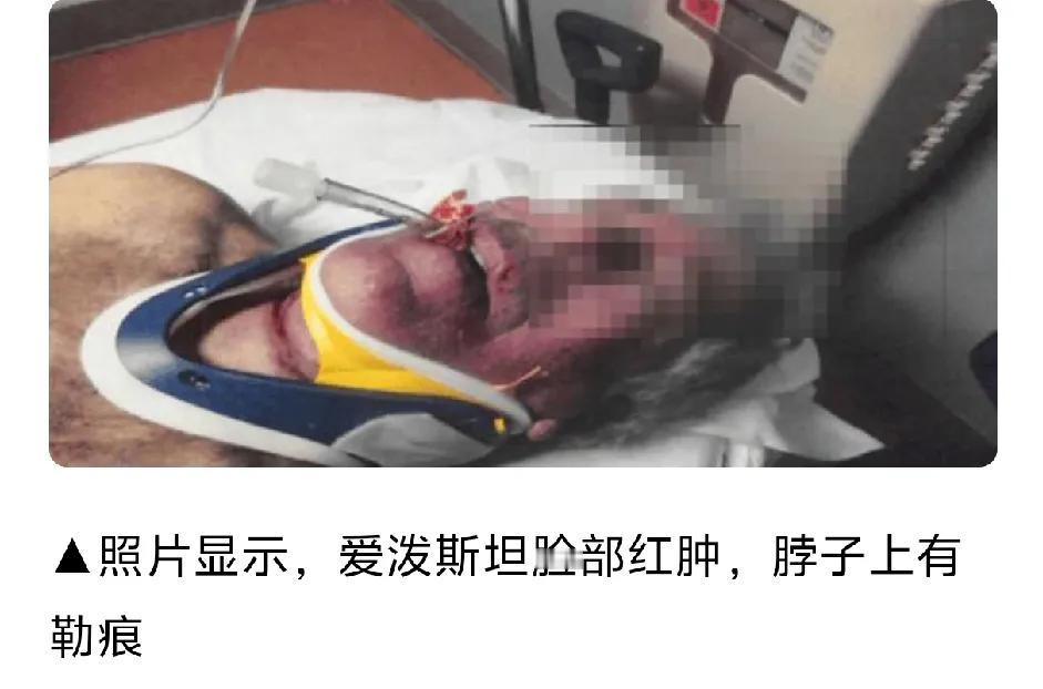 2019年7月爱泼斯坦入狱，8月他自缢了，自缢后的照片首度公开。脖子上有很深的血