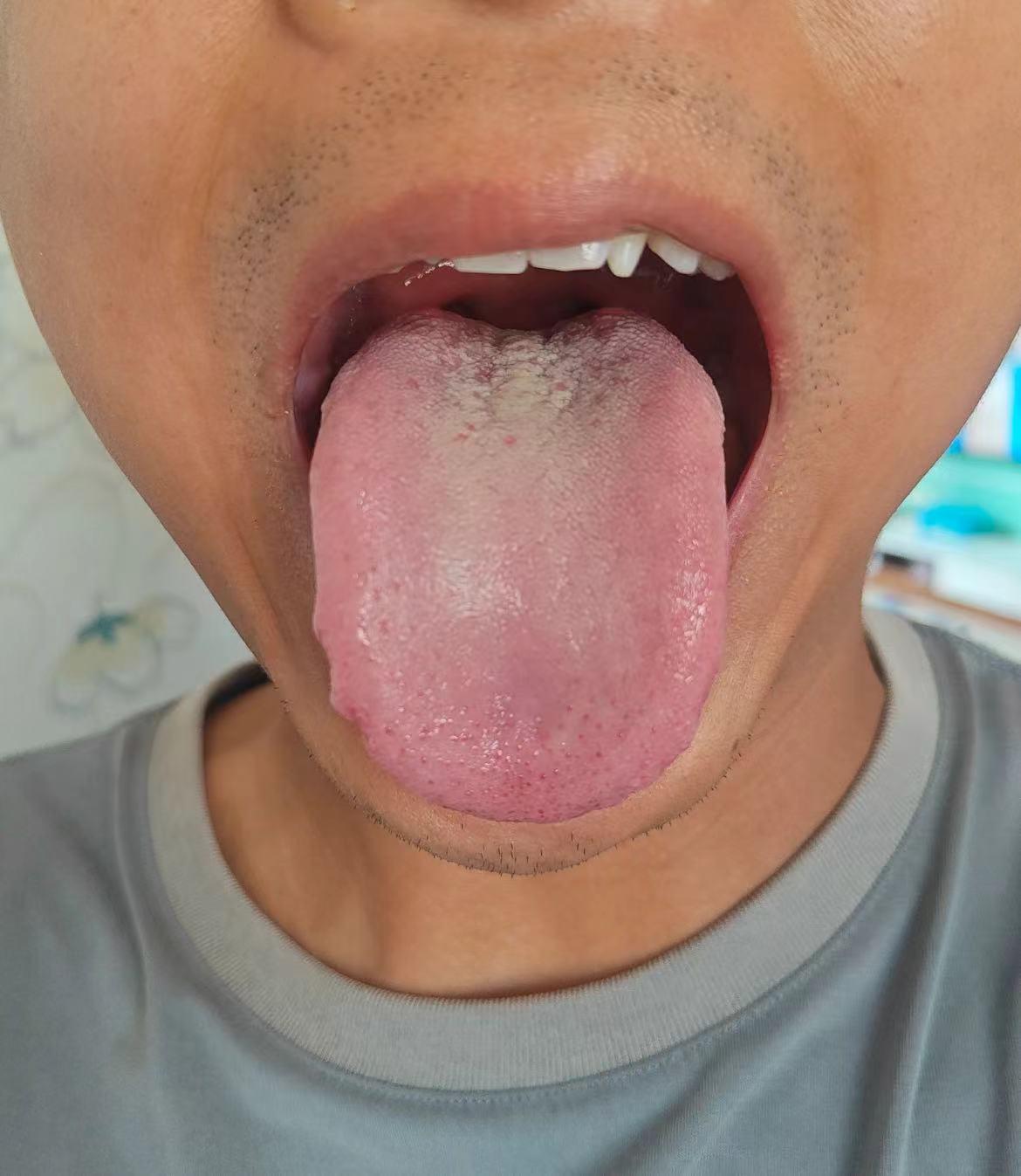 你这个舌头吧，问题说大也不大，说小也不小，就是可能调着很费劲[看]

咱们先来看