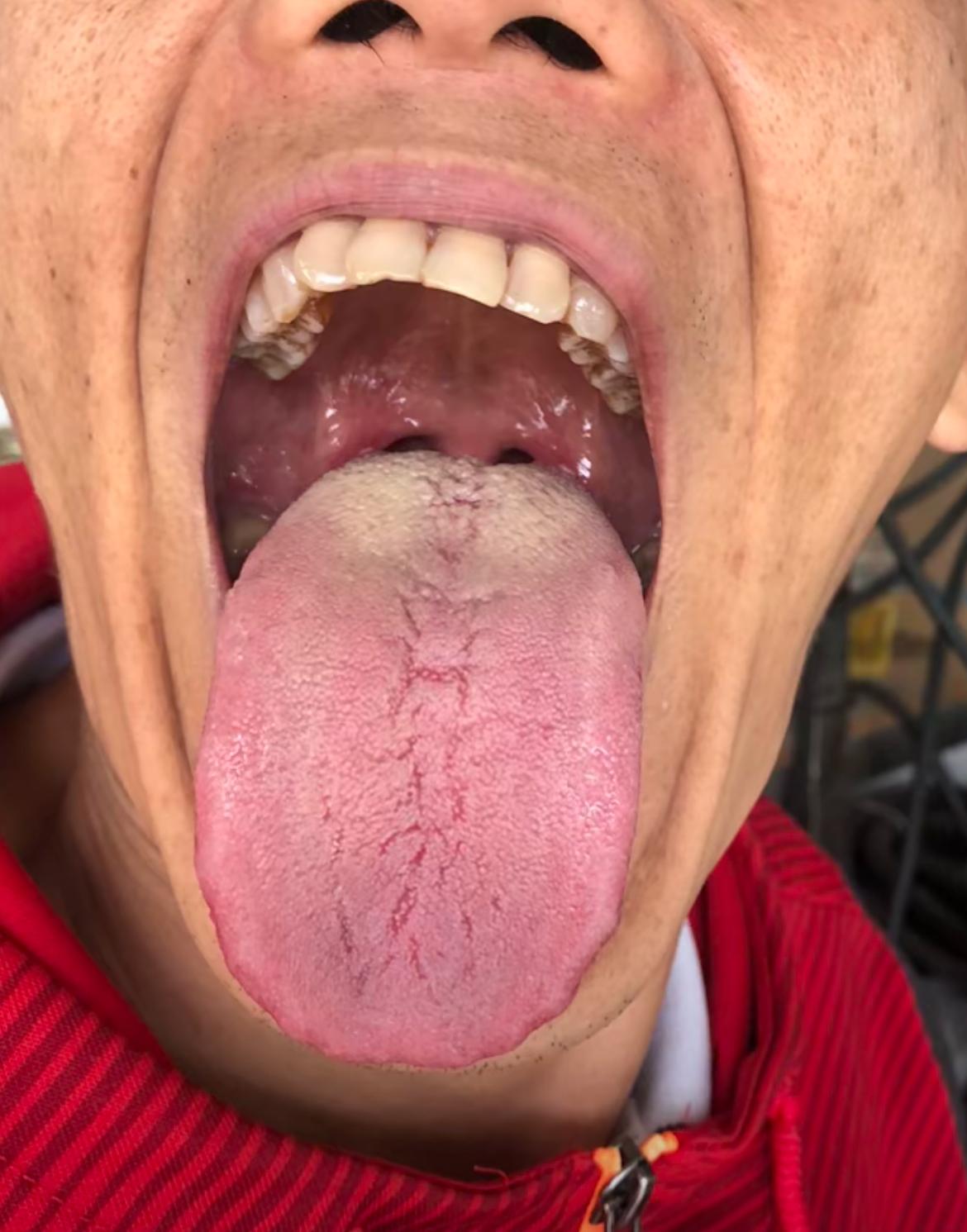 这样的舌根，这样的裂纹，这样的舌苔[泣不成声]
那你注定男科差劲了！男儿行不行，